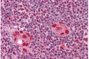 Human Thymus: Formalin-Fixed, Paraffin-Embedded (FFPE) (CUX1 抗体  (AA 521-621))