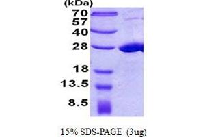 SDS-PAGE (SDS) image for COMM Domain Containing 7 (COMMD7) (AA 1-200) protein (His tag) (ABIN5852998) (COMMD7 Protein (AA 1-200) (His tag))