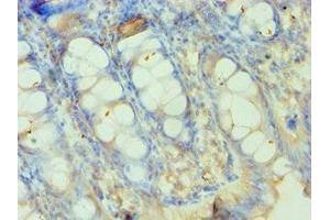 Immunohistochemistry of paraffin-embedded human colon tissue using ABIN7155524 at dilution of 1:100 (SMYD3 抗体  (AA 199-428))