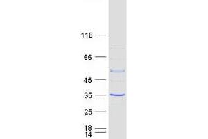Western Blotting (WB) image for RAB40B, Member RAS Oncogene Family (RAB40B) protein (Myc-DYKDDDDK Tag) (ABIN2730356)