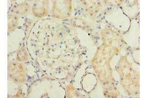 Immunohistochemistry of paraffin-embedded human kidney tissue using ABIN7173115 at dilution of 1:100 (TMEM186 抗体  (AA 124-213))
