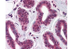 IHC Information: Paraffin embedded breast tissue, tested with an antibody dilution of 5 ug/ml. (T-Box 18 抗体  (C-Term))