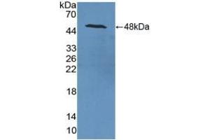 Detection of Recombinant NSE, Rat using Polyclonal Antibody to Enolase, Neuron Specific (NSE) (ENO2/NSE 抗体  (AA 2-434))