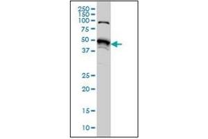 Western Blotting (WB) image for anti-serine/threonine Kinase 38 (STK38) (AA 365-466) antibody (ABIN954986) (STK38 抗体  (AA 365-466))