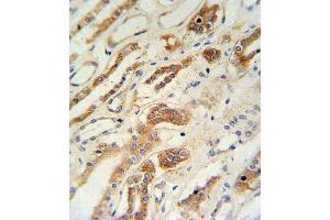 ZFYVE16 Antibody (N-term) (ABIN651313 and ABIN2840182) IHC analysis in formalin fixed and paraffin embedded lung tissue followed by peroxidase conjugation of the secondary antibody and DAB staining. (ZFYVE16 抗体  (N-Term))