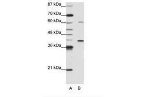 Image no. 1 for anti-Zinc Finger Protein 843 (ZNF843) (AA 41-90) antibody (ABIN6736171) (ZNF843 抗体  (AA 41-90))