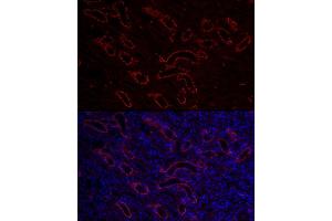 Immunofluorescence analysis of mouse kidney cells using  Rabbit pAb (ABIN3016811, ABIN3016812, ABIN3016813, ABIN1678723 and ABIN6219847) at dilution of 1:150 (40x lens). (AQP3 抗体  (AA 178-292))