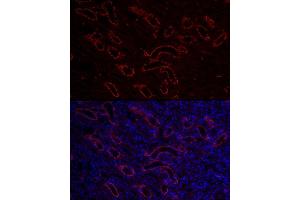 Immunofluorescence analysis of mouse kidney cells using  Rabbit pAb (ABIN3016811, ABIN3016812, ABIN3016813, ABIN1678723 and ABIN6219847) at dilution of 1:150 (40x lens). (AQP3 抗体  (AA 178-292))