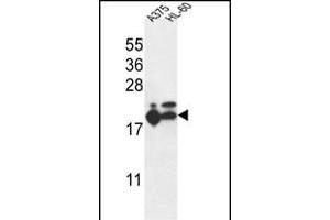 RPL17 Antibody (C-term) (ABIN653848 and ABIN2843111) western blot analysis in ,HL-60 cell line lysates (35 μg/lane). (RPL17 抗体  (C-Term))