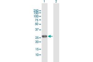Western Blotting (WB) image for anti-Uroporphyrinogen III Synthase (UROS) (AA 1-265) antibody (ABIN521283)