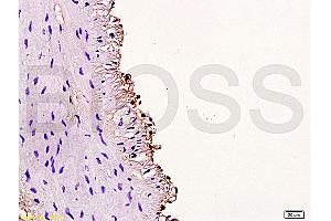 Formalin-fixed and paraffin embedded rabbit carotid artery labeled Anti-Cyclin D3 Polyclonal Antibody, Unconjugated (ABIN671571) at 1:200, followed by conjugation to the secondary antibody and DAB staining (Cyclin D3 抗体  (AA 121-220))