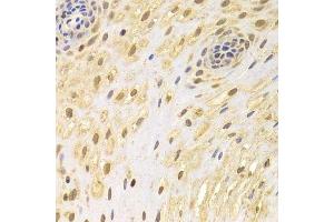 Immunohistochemistry of paraffin-embedded human esophagus using AIFM1 Antibody.