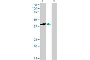 Western Blot analysis of SHOX2 expression in transfected 293T cell line by SHOX2 monoclonal antibody (M01), clone 1D1. (SHOX2 抗体  (AA 117-204))