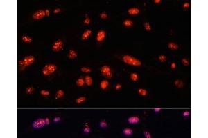 Immunofluorescence analysis of U-2 OS cells using ILF3 Polyclonal Antibody at dilution of 1:100. (Interleukin enhancer-binding factor 3 (ILF3) 抗体)