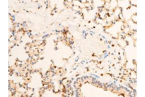 ABIN6267286 at 1/100 staining mouse lung tissue sections by IHC-P. (TRKA 抗体  (pTyr681, Tyr680))