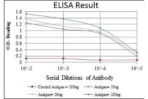 Red: Control Antigen (100 ng), Purple: Antigen (10 ng), Green: Antigen (50 ng), Blue: Antigen (100 ng), (KIF22 抗体)