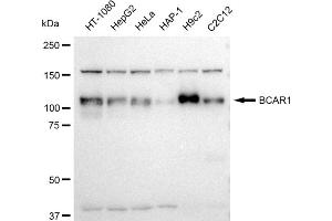 Western blotting analysis using BCAR1 antibody (ABIN7797791). (Recombinant BCAR1 抗体)