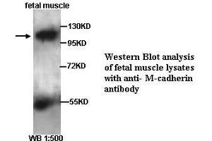 Image no. 2 for anti-M-Cadherin (CDH15) (Internal Region) antibody (ABIN790873) (CDH15 抗体  (Internal Region))