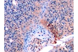 Detection of MMP9 in Human Tonsil Tissue using Monoclonal Antibody to Matrix Metalloproteinase 9 (MMP9)