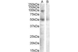 Image no. 1 for anti-Sulfatase 2 (SULF2) (Internal Region) antibody (ABIN375090) (SULF2 抗体  (Internal Region))