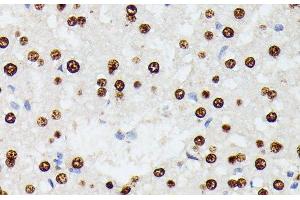 Immunohistochemistry of paraffin-embedded Rat liver using HNRNPD Polyclonal Antibody at dilution of 1:100 (40x lens). (HNRNPD/AUF1 抗体)