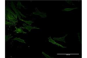 Immunofluorescence of monoclonal antibody to ACE on HeLa cell. (Angiotensin I Converting Enzyme 1 抗体  (AA 592-701))