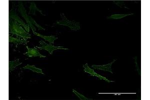 Immunofluorescence of monoclonal antibody to ACE on HeLa cell.