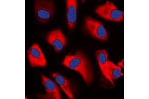 Immunofluorescent analysis of CDC37 staining in K562 cells.