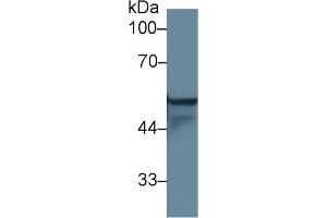 Western Blot; Sample: Human A431 cell lysate; Primary Ab: 1µg/ml Rabbit Anti-Rat KRT4 Antibody Second Ab: 0. (KRT4 抗体  (AA 317-454))