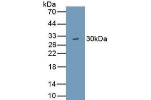 Detection of Recombinant WDR90, Human using Polyclonal Antibody to WD Repeat Containing Domain Protein 90 (WDR90) (WDR90 抗体  (AA 1-235))