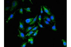 Immunofluorescent analysis of Hela cells using ABIN7151111 at dilution of 1:100 and Alexa Fluor 488-congugated AffiniPure Goat Anti-Rabbit IgG(H+L) (RBBP6 抗体  (AA 51-97))
