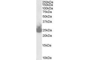 Western Blotting (WB) image for Synaptosomal-Associated Protein, 25kDa (SNAP25) peptide (ABIN368831) (Synaptosomal-Associated Protein, 25kDa (SNAP25) Peptide)