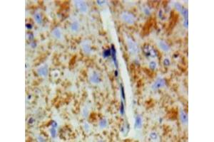 Used in DAB staining on fromalin fixed paraffin-embedded Brain tissue (DVL2 抗体  (AA 78-250))
