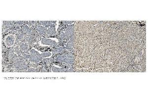 IHC analysis of MCM5 using anti-MCM5 antibody (ABIN7600583).