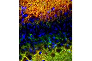 Immunohistochemistry (IHC) image for anti-SynCAM 1/2/3 (AA 436-446) antibody (ABIN1742491) (SynCAM 1/2/3 (AA 436-446) 抗体)