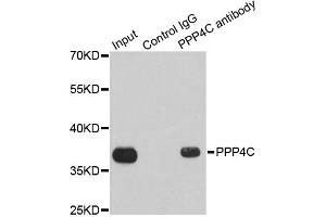 Immunoprecipitation analysis of 200ug extracts of 293T cells using 1ug PPP4C antibody. (PPP4C 抗体)