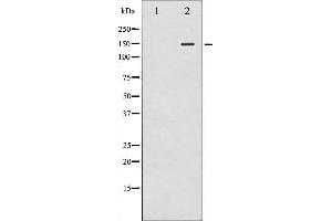 Western blot analysis of iNOS phosphorylation expression in whole cell lysates,The lane on the left is treated with the antigen-specific peptide. (NOS2 抗体  (pTyr151))