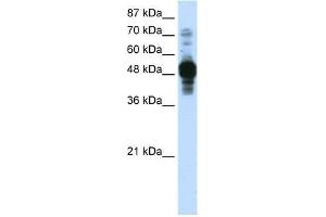 Transfected 293T; WB Suggested Anti-ZNF342 Antibody Titration: 0. (Zinc Finger Protein 296 (ZNF296) (C-Term) 抗体)