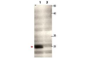 Western blot using  protein A purified anti-CENP-Q antibody shows detection of endogenous CENP-Q in a HeLa whole cell lysate (lane 1, arrowhead). (CENPQ 抗体)