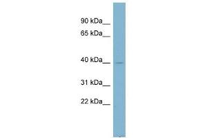 NDUFA9 antibody used at 1 ug/ml to detect target protein. (NDUFA9 抗体)