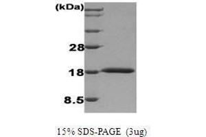 Figure annotation denotes ug of protein loaded and % gel used. (IFNA1 蛋白)