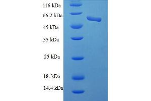 SDS-PAGE (SDS) image for Casein Kinase 2 alpha 1 (CSNK2A1) (AA 8-350), (partial) protein (His-SUMO Tag) (ABIN5711209) (CSNK2A1/CK II alpha Protein (AA 8-350, partial) (His-SUMO Tag))