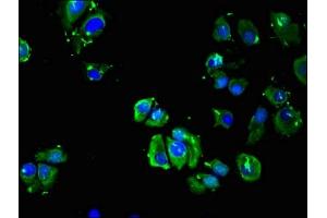 Immunofluorescent analysis of MCF-7 cells using ABIN7145429 at dilution of 1:100 and Alexa Fluor 488-congugated AffiniPure Goat Anti-Rabbit IgG(H+L) (ADRB3 抗体  (AA 1-36))
