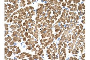 Tropomyosin 2 antibody was used for immunohistochemistry at a concentration of 4-8 ug/ml to stain Skeletal muscle cells (arrows) in Human Muscle. (TPM2 抗体)