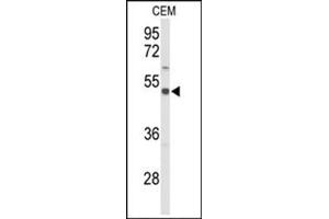 Western blot analysis in CEM cerebellum cell line lysates (35 ug/lane) using SLC39A8 Antibody (Center) Cat.