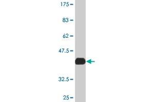 Western Blot detection against Immunogen (37. (MAPK6 抗体  (AA 612-721))