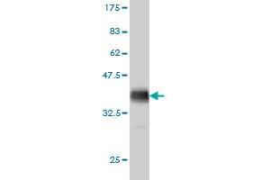 Western Blot detection against Immunogen (35. (HDAC6 抗体  (AA 1128-1215))