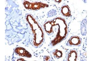 Image no. 2 for anti-Keratin 18 (KRT18) antibody (ABIN6179389) (Cytokeratin 18 抗体)