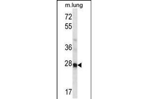 Western blot analysis in mouse lung tissue lysates (35ug/lane). (HOXA4 抗体  (N-Term))