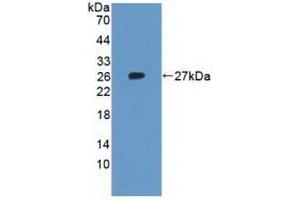 Detection of Recombinant RPL23A, Human using Polyclonal Antibody to Ribosomal Protein L23A (RPL23A) (RPL23A 抗体  (AA 2-156))